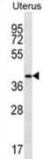 Olfactory Receptor Family 2 Subfamily V Member 2 antibody, abx027317, Abbexa, Western Blot image 