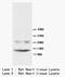 Phospholamban antibody, GTX37204, GeneTex, Western Blot image 