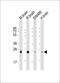 RAB3B, Member RAS Oncogene Family antibody, M09431, Boster Biological Technology, Western Blot image 