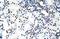 Nucleolin antibody, GTX47363, GeneTex, Immunohistochemistry paraffin image 