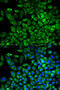 Aldolase, Fructose-Bisphosphate A antibody, 14-017, ProSci, Immunofluorescence image 