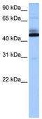 Transmembrane Protein 266 antibody, TA338818, Origene, Western Blot image 