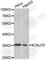 Potassium Voltage-Gated Channel Subfamily J Member 15 antibody, A3932, ABclonal Technology, Western Blot image 