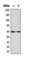 Eukaryotic Translation Initiation Factor 2B Subunit Delta antibody, orb393270, Biorbyt, Western Blot image 