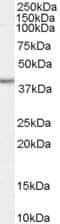 Biglycan antibody, PA5-18606, Invitrogen Antibodies, Western Blot image 