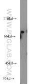 RAS Guanyl Releasing Protein 3 antibody, 13162-1-AP, Proteintech Group, Western Blot image 