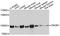 Phosphoinositide-3-Kinase Regulatory Subunit 1 antibody, A11442, ABclonal Technology, Western Blot image 