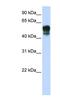 Sphingolipid Transporter 1 (Putative) antibody, NBP1-59999, Novus Biologicals, Western Blot image 