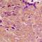 Proteasome 26S Subunit, ATPase 3 antibody, LS-C368682, Lifespan Biosciences, Immunohistochemistry paraffin image 