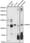 G Protein Regulated Inducer Of Neurite Outgrowth 1 antibody, LS-C750524, Lifespan Biosciences, Western Blot image 