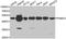 Proteasome 26S Subunit, ATPase 5 antibody, A1538, ABclonal Technology, Western Blot image 