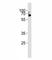 LCK Proto-Oncogene, Src Family Tyrosine Kinase antibody, F48246-0.4ML, NSJ Bioreagents, Immunohistochemistry paraffin image 