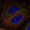 CTD Nuclear Envelope Phosphatase 1 Regulatory Subunit 1 antibody, NBP2-58839, Novus Biologicals, Immunofluorescence image 