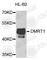 Doublesex- and mab-3-related transcription factor 1 antibody, A8411, ABclonal Technology, Western Blot image 