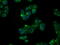 Natriuretic Peptide Receptor 3 antibody, M03589-3, Boster Biological Technology, Immunofluorescence image 