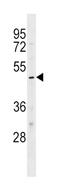 Potassium Voltage-Gated Channel Subfamily J Member 10 antibody, abx029373, Abbexa, Western Blot image 