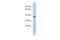 RWD Domain Containing 2A antibody, A18148, Boster Biological Technology, Western Blot image 