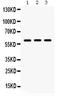 Lumican antibody, PB9662, Boster Biological Technology, Western Blot image 