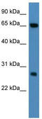 Kelch Repeat And BTB Domain Containing 8 antibody, TA342894, Origene, Western Blot image 