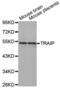 TRAF Interacting Protein antibody, abx002407, Abbexa, Western Blot image 