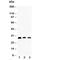 Aquaporin 1 (Colton Blood Group) antibody, R30178, NSJ Bioreagents, Western Blot image 