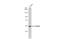 Cytochrome P450 Family 26 Subfamily B Member 1 antibody, GTX104932, GeneTex, Western Blot image 