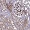 Tensin 1 antibody, PA5-57515, Invitrogen Antibodies, Immunohistochemistry paraffin image 