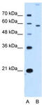 S22A2 antibody, TA334041, Origene, Western Blot image 