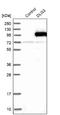 Discs Large MAGUK Scaffold Protein 3 antibody, NBP1-87691, Novus Biologicals, Western Blot image 