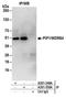p21-activated protein kinase-interacting protein 1 antibody, A301-549A, Bethyl Labs, Immunoprecipitation image 