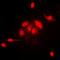 N-6 Adenine-Specific DNA Methyltransferase 1 antibody, abx141535, Abbexa, Western Blot image 