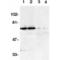 TNF Receptor Superfamily Member 21 antibody, AHP585, Bio-Rad (formerly AbD Serotec) , Western Blot image 