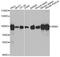 Ribonucleotide Reductase Catalytic Subunit M1 antibody, MBS126571, MyBioSource, Western Blot image 