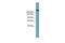 ATP Binding Cassette Subfamily A Member 12 antibody, PA5-42400, Invitrogen Antibodies, Western Blot image 