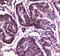 SWI/SNF Related, Matrix Associated, Actin Dependent Regulator Of Chromatin, Subfamily A, Member 4 antibody, A00223-1, Boster Biological Technology, Immunohistochemistry frozen image 