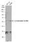 LCK Proto-Oncogene, Src Family Tyrosine Kinase antibody, GTX133876, GeneTex, Western Blot image 