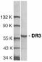 TNF Receptor Superfamily Member 25 antibody, LS-B2705, Lifespan Biosciences, Western Blot image 