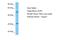 Potassium Voltage-Gated Channel Interacting Protein 2 antibody, A30139, Boster Biological Technology, Western Blot image 