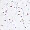 DEAD-Box Helicase 3 X-Linked antibody, GTX54030, GeneTex, Immunohistochemistry paraffin image 