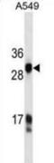 Kallikrein Related Peptidase 3 antibody, abx025469, Abbexa, Western Blot image 
