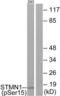 Stathmin 1 antibody, LS-C117488, Lifespan Biosciences, Western Blot image 