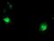 Dystrobrevin Beta antibody, MA5-25885, Invitrogen Antibodies, Immunocytochemistry image 