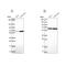 Asparagine Synthetase (Glutamine-Hydrolyzing) antibody, NBP2-56407, Novus Biologicals, Western Blot image 