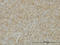 TNF Superfamily Member 14 antibody, LS-C133566, Lifespan Biosciences, Immunohistochemistry paraffin image 