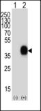 CD38 Molecule antibody, GTX81962, GeneTex, Western Blot image 
