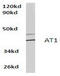 Angiotensin II type-1 receptor antibody, AP01262PU-N, Origene, Western Blot image 