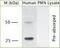 Proteinase 3 antibody, NBP1-25966, Novus Biologicals, Western Blot image 