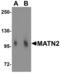 Matrilin 2 antibody, NBP1-76328, Novus Biologicals, Western Blot image 