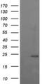 RAB37, Member RAS Oncogene Family antibody, NBP2-45926, Novus Biologicals, Western Blot image 
