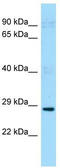Phosducin Like 2 antibody, TA338838, Origene, Western Blot image 